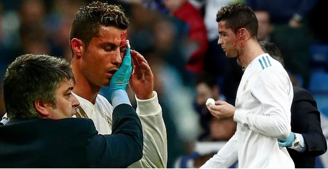Cristiano Ronaldo herida vs Dépor